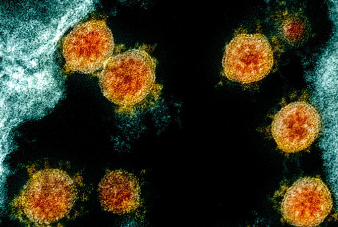 Transmission electron micrograph of SARS-CoV-2 virus particles (orange), isolated from a patient.