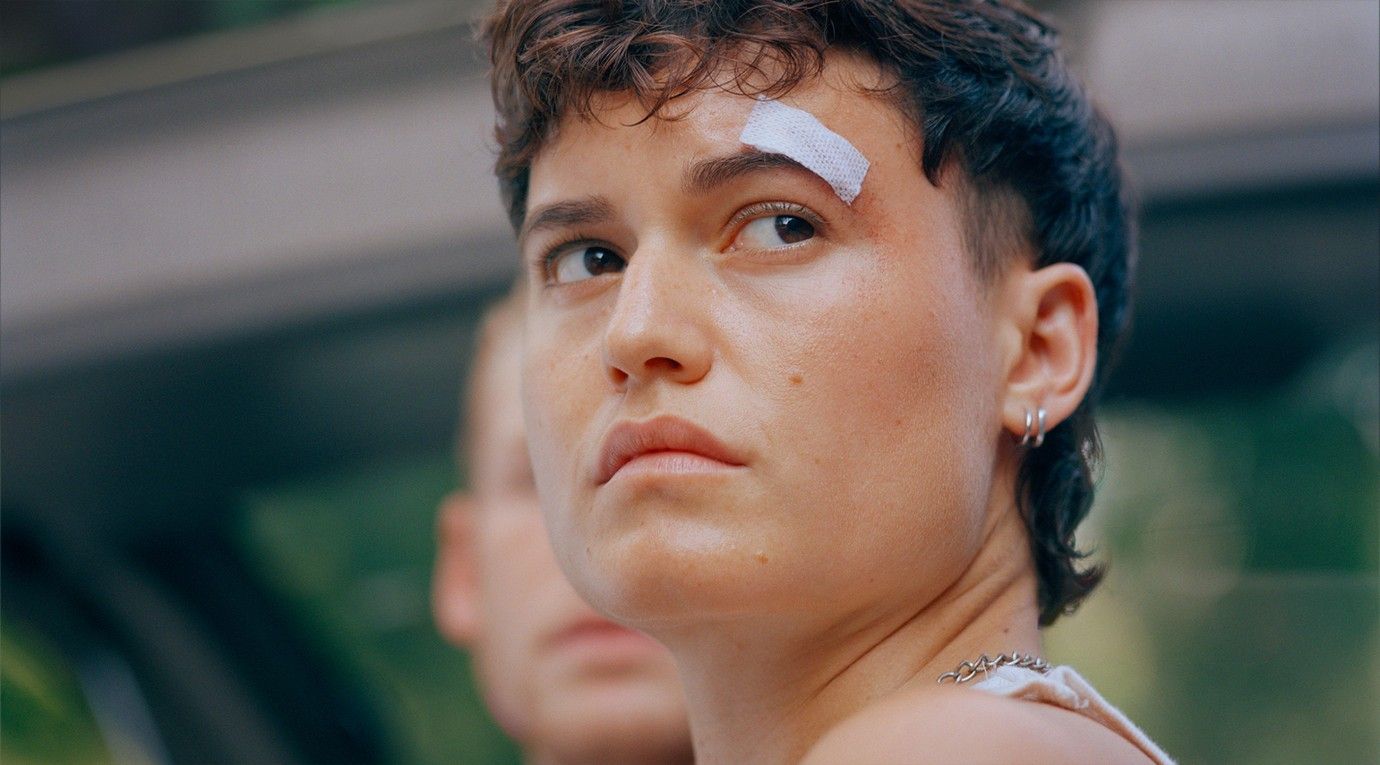 A young trans man with a plaster on his eyebrow. 