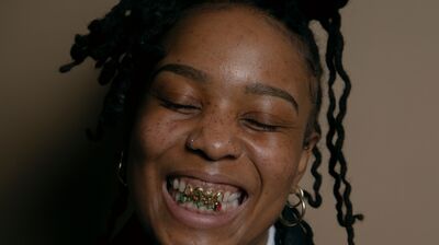 A woman with braids and gold grillz on their teeth